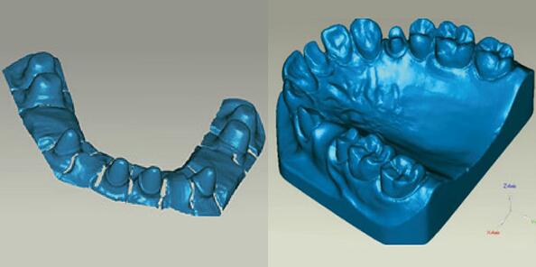 上海抄數服務公司提供的口腔抄數服務
